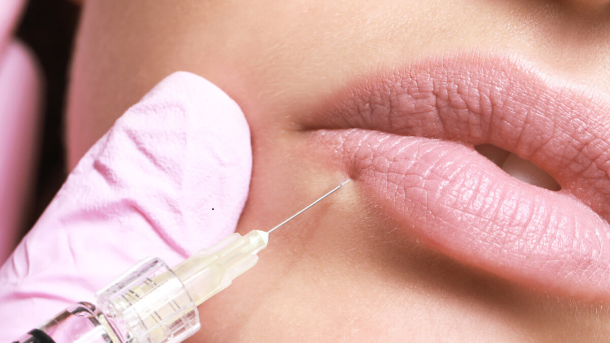 بهترین دکتر برای فیلر لب در اصفهان