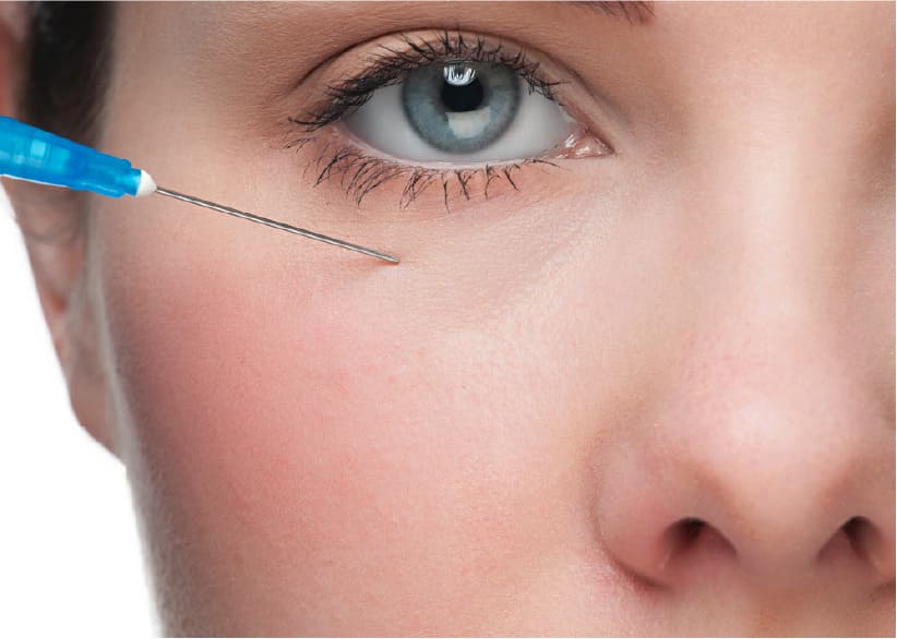 هزینه فیلر زیر چشم در اصفهان