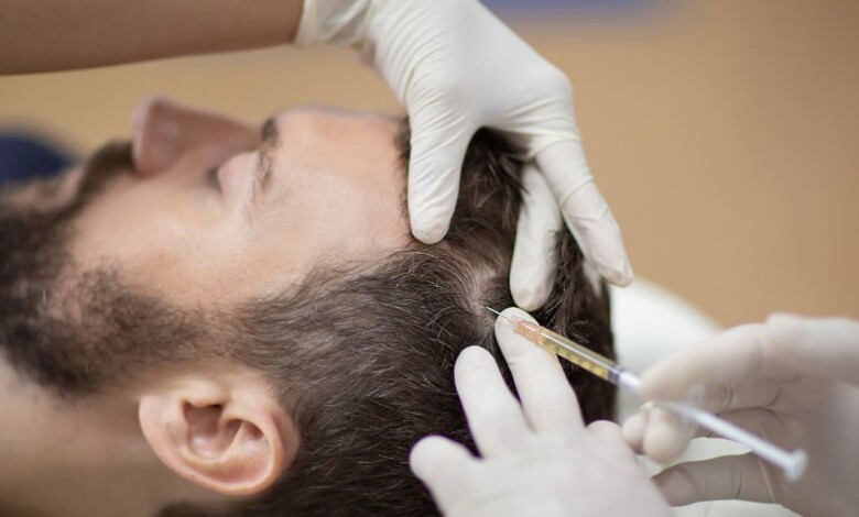 بهترین مرکز مزوتراپی مو در اصفهان