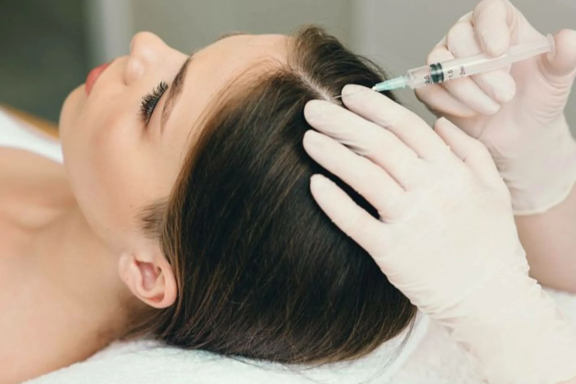 بهترین مزوتراپی مو در اصفهان نی نی سایت