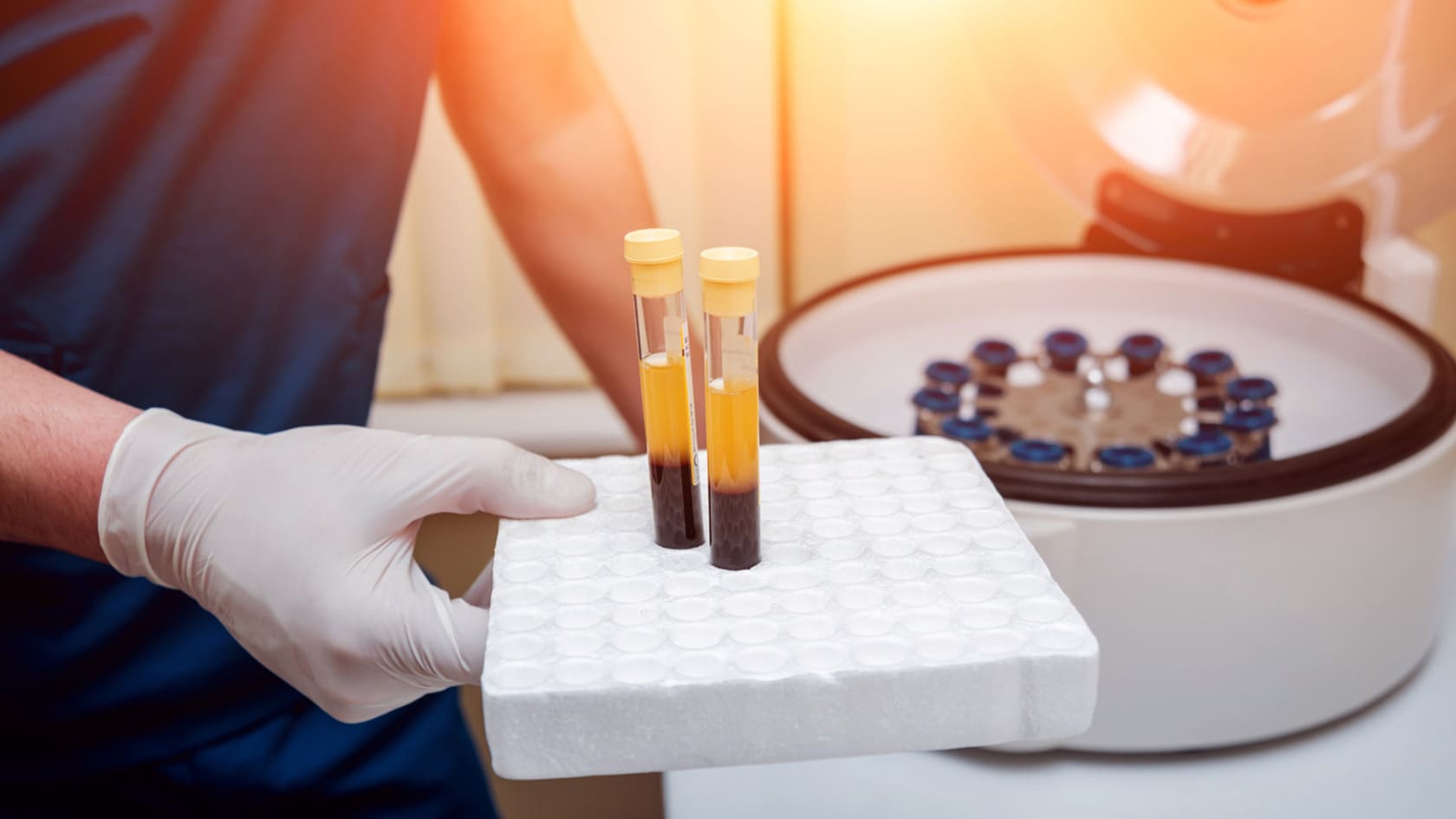 بهترین مرکز پی آر پی مو در اصفهان