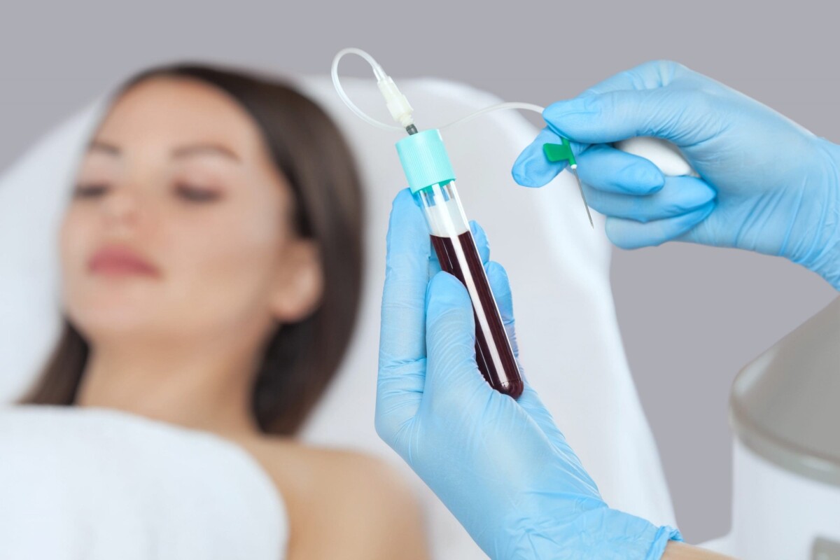 بهترین پی آر پی مو در اصفهان نی نی سایت