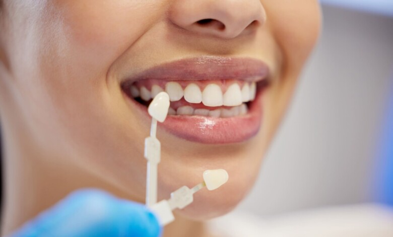 بهترین دکتر کامپوزیت دندان در اصفهان