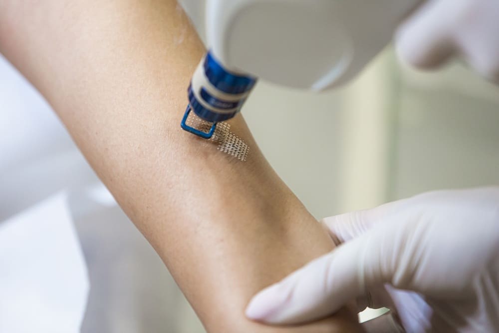 بهترین مرکز لیزر جای زخم در اصفهان