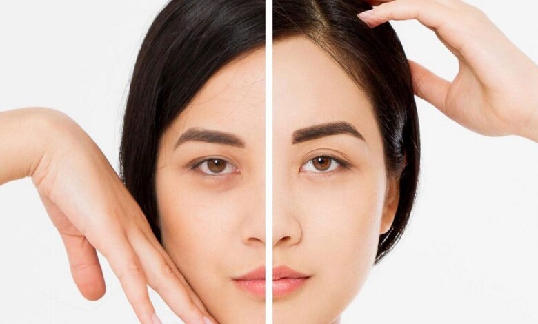 بهترین دکتر لیفت شقیقه در اصفهان