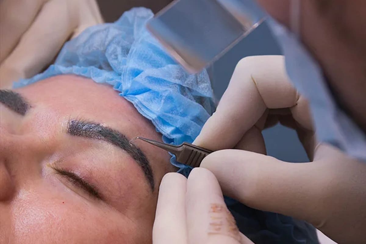 بهترین کلینیک کاشت ابرو در اصفهان نی نی سایت