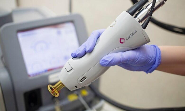 بهترین لیزر الکس کندلا در اصفهان