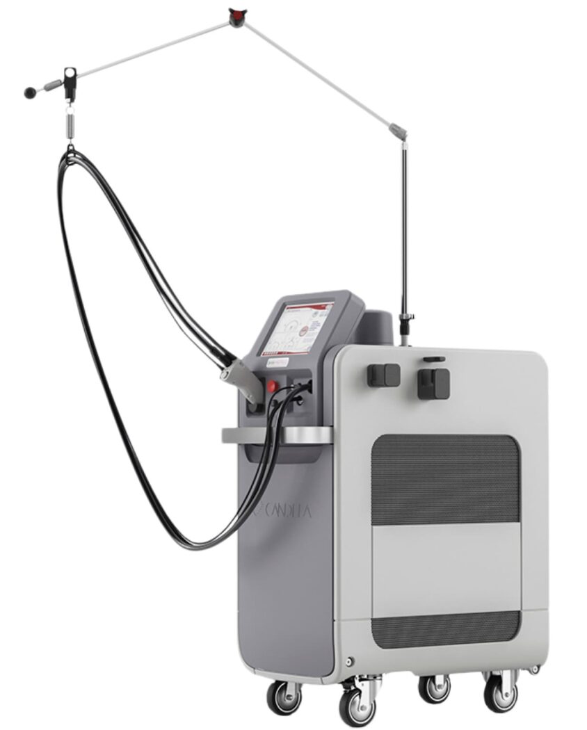 لیزر الکس کندلا در اصفهان