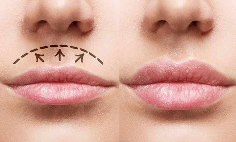 بهترین دکتر سانترال لب در اصفهان