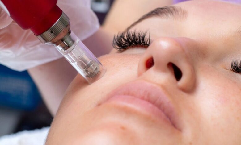 بهترین دکتر میکرونیدلینگ در اصفهان