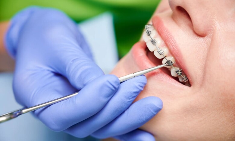 بهترین دکتر ارتودنسی در اصفهان