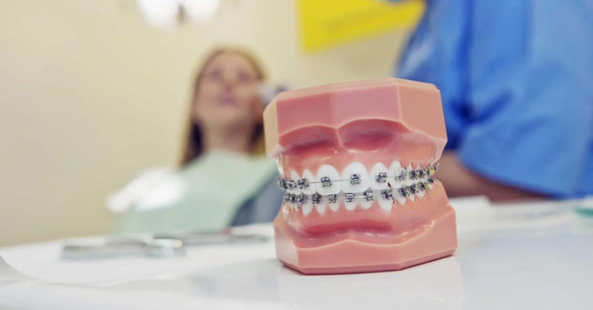 بهترین دکتر ارتودنسی در اصفهان نی نی سایت