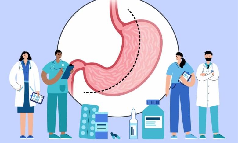 بهترین دکتر اسلیو معده در اصفهان