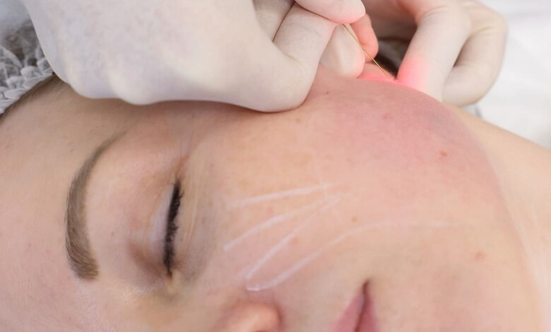 لیست بهترین دکتر اندولیفت در اصفهان و مشخصات آن ها