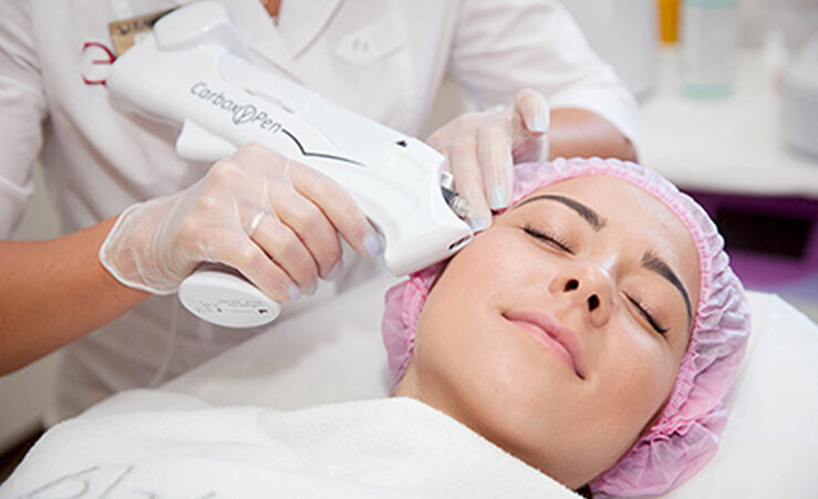 کربوکسی تراپی مو در اصفهان