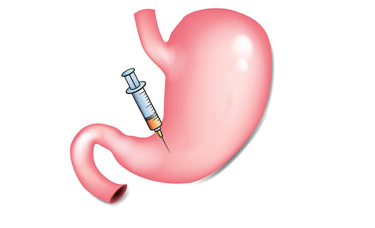 بهترین دکتر بوتاکس معده در اصفهان