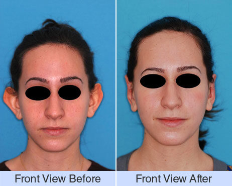 دکتر جراحی گوش در اصفهان