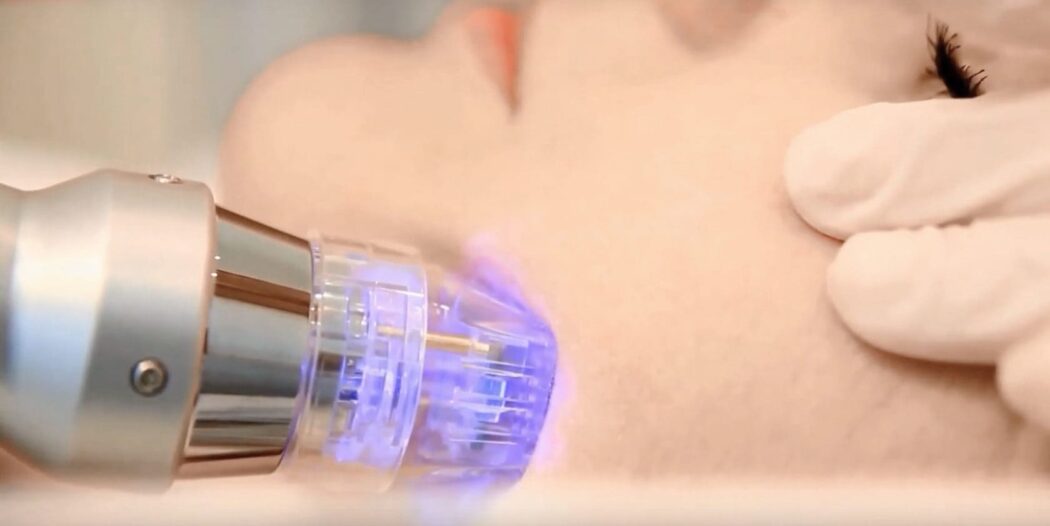 آر اف نانو در اصفهان