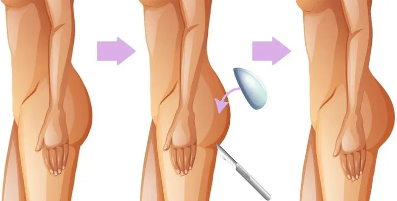بهترین دکتر جراحی پروتز باسن در اصفهان