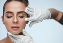 بهترین جراح پلک در شیراز