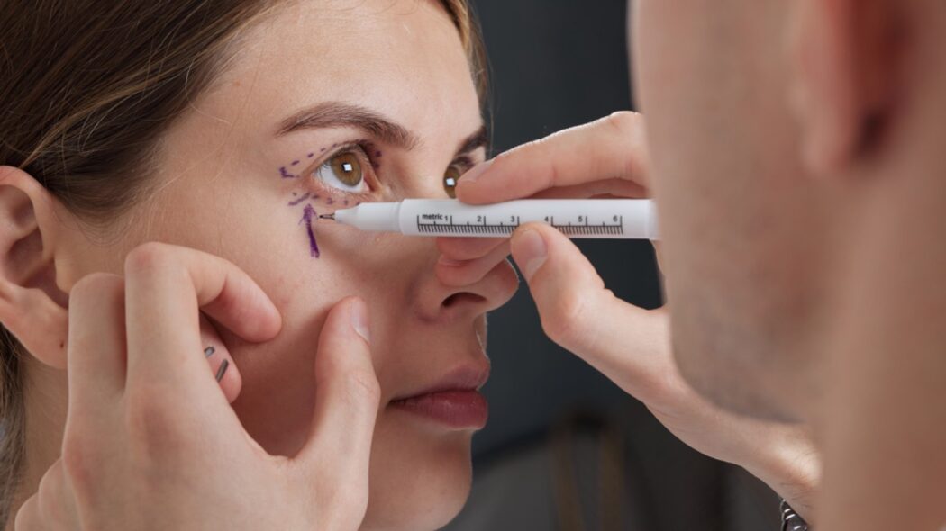 بلفاروپلاستی شیراز