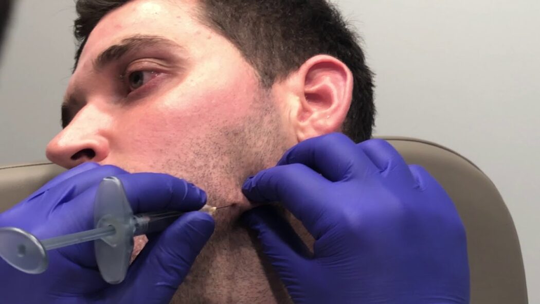 بهترین دکتر تزریق فیلر در شیراز