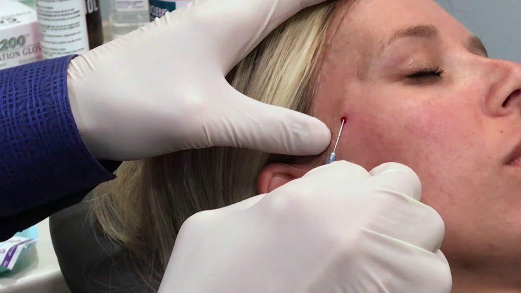 بهترین دکتر تزریق فیلر در شیراز