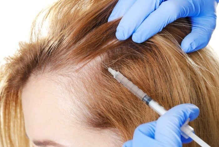 بهترین دکتر مزوتراپی مو در شیراز