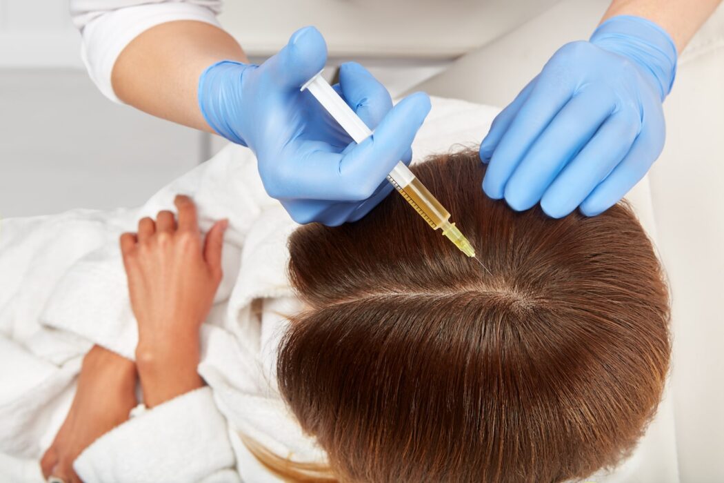 بهترین مزوتراپی مو در شیراز نی نی سایت