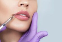 بهترین دکتر تزریق ژل لب در شیراز