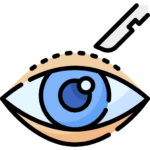 بلفاروپلاستی